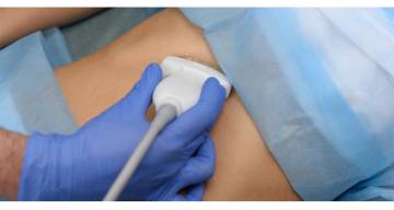 El Gobierno nacional desreguló la importación de equipamiento médico usado y reacondicionado