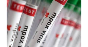 Confirman el primer caso de viruela símica Clado Ib en Argentina: severa y contagiosa